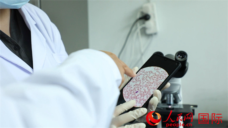 Timu ya Madaktari wa China ya Kikosi cha 25 cha walinda amani nchini DRC  yatumia Akili Bandia (AI) Kuthibitisha haraka ugonjwa wa Malaria 